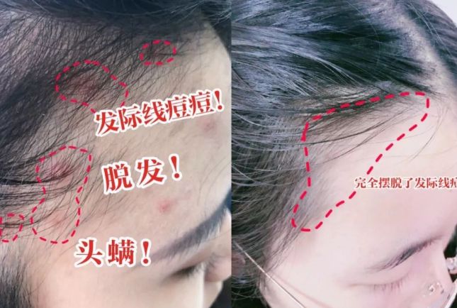 吹干好?10分钟轻松养成女明星「绸缎发」冰球突破豪华版app洗完头自然风干还是(图6) 吹干好?10分钟轻松养成女明星「绸缎发」冰球突破豪华版app洗完头自然风干还是(图6)